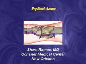 Popliteal Access Steve Ramee MD Ochsner Medical Center