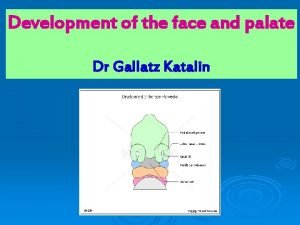 Development of the face and palate Dr Gallatz