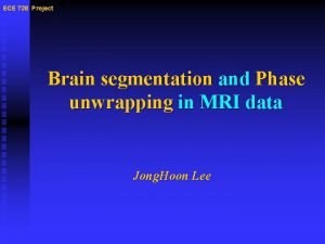 ECE 738 Project Brain segmentation and Phase unwrapping