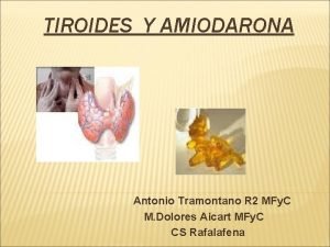 TIROIDES Y AMIODARONA Antonio Tramontano R 2 MFy