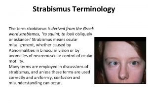 Latent strabismus