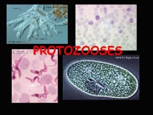 PROTOZOOSES Protozooses Amebase Giardase Doena de Chagas Leishmaniose