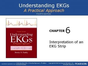 Understanding ekgs a practical approach