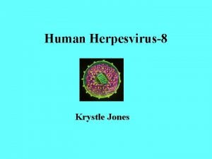 Human Herpesvirus8 Krystle Jones Background HHV8 was discovered