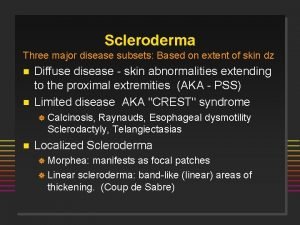 Scleroderma Three major disease subsets Based on extent