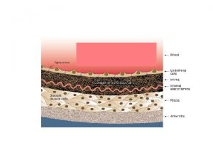 ATEROSCLEROSI reaction to injury hypothesis teoria della reazione