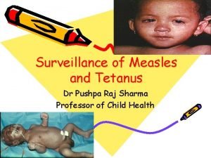 Surveillance of Measles and Tetanus Dr Pushpa Raj