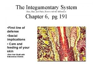 Sinple columnar