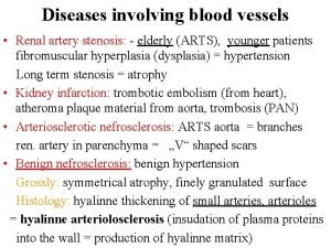 Diseases involving blood vessels Renal artery stenosis elderly