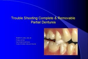 Trouble Shooting Complete Removable Partial Dentures Robert W