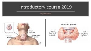 Pictures of thyroid eye disease