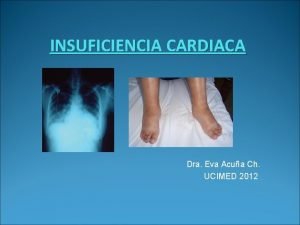 INSUFICIENCIA CARDIACA Dra Eva Acua Ch UCIMED 2012