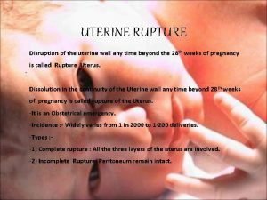 UTERINE RUPTURE Disruption of the uterine wall any