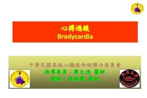 Bradycardia Sinus bradycardia EKG 1 1 AV block
