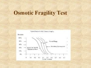 Osmotic Fragility Test Osmotic fragility Definition Osmotic fragility