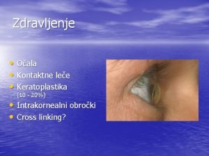 Zdravljenje Oala Kontaktne lee Keratoplastika 10 20 Intrakornealni