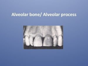 Alveolar bone Alveolar process Is the portion of