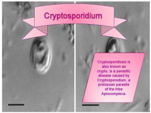 Cryptosporidium Cryptosporidiosis is also known as crypto is