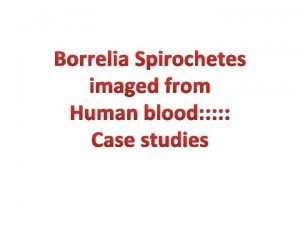 Borrelia Spirochetes imaged from Human blood Case studies