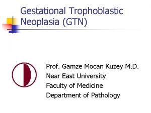 Gestational Trophoblastic Neoplasia GTN Prof Gamze Mocan Kuzey