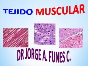 Los tres tipos de musculos