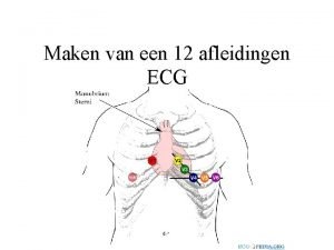 Ecg elektroden plaatsen