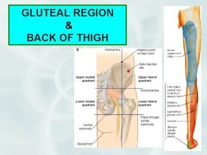 Sciatic nerve passes through which foramen Sciatic nerve passes through which foramen