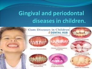 Gingival and periodontal diseases in children The gingiva