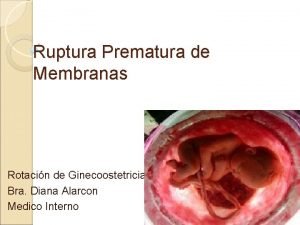 Diagnostico de ruptura prematura de membranas