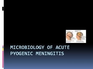 MICROBIOLOGY OF ACUTE PYOGENIC MENINGITIS Definition Pyogenic meningitis