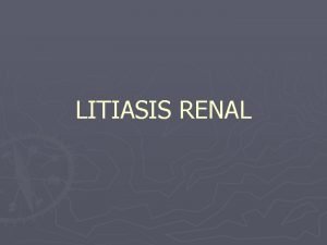 LITIASIS RENAL Corresponde a la presencia de concreciones