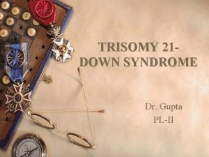 TRISOMY 21 DOWN SYNDROME Dr Gupta PLII Incidence