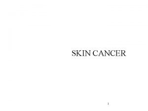 SKIN CANCER 1 Skin cancer is caused due