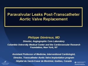 Paravalvular Leaks PostTranscatheter Aortic Valve Replacement Philippe Gnreux