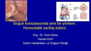 Souk konizasyonda yeni bir yntem Hemostatik serklaj str