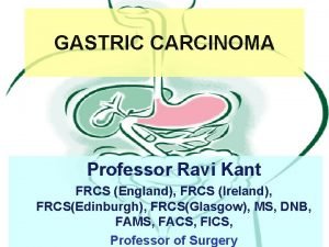 GASTRIC CARCINOMA Professor Ravi Kant FRCS England FRCS