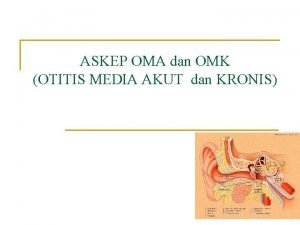 ASKEP OMA dan OMK OTITIS MEDIA AKUT dan