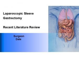 Laparoscopic Sleeve Gastrectomy Recent Literature Review Surgeon Date