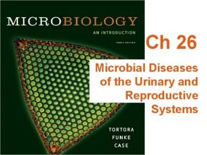 Ch 26 Microbial Diseases of the Urinary and
