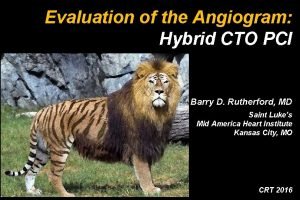 Evaluation of the Angiogram Hybrid CTO PCI Barry