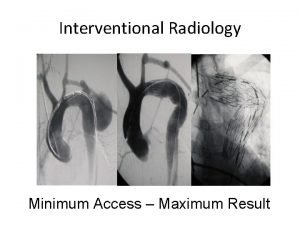 Interventional Radiology Minimum Access Maximum Result Interventional Radiology