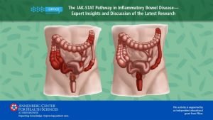 Filgotinib ulcerative colitis