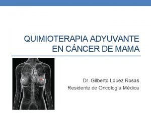 QUIMIOTERAPIA ADYUVANTE EN CNCER DE MAMA Dr Gilberto