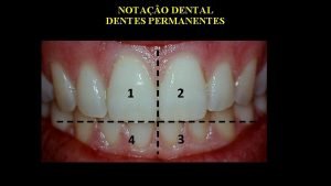 Dente 12