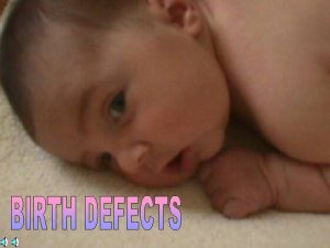 What Are Birth Defects Birth defects are defined