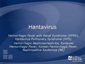 Hantavirus humans