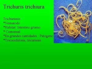 Trichuris trichiura Trichuriasis Nematodo Habitat Intestino grueso Comensal