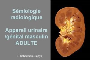 Smiologie radiologique Appareil urinaire gnital masculin ADULTE E