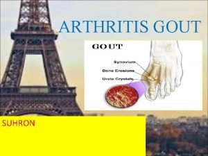 Anatomi fisiologi gout arthritis