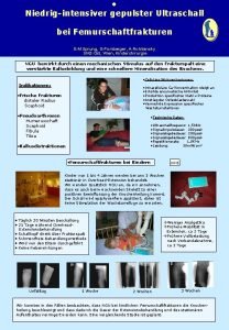 Niedrigintensiver gepulster Ultraschall bei Femurschaftfrakturen E M Sprung
